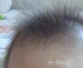 生後4ヶ月赤ちゃんの髪