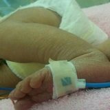 NICU