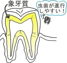 象牙質
